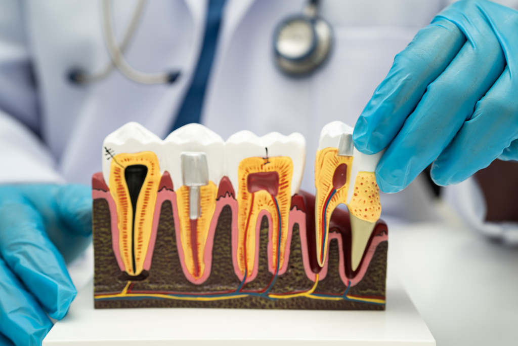 Periodontal Disease and Diabetes