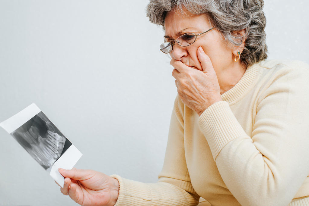 Periodontal Disease and Osteoporosis