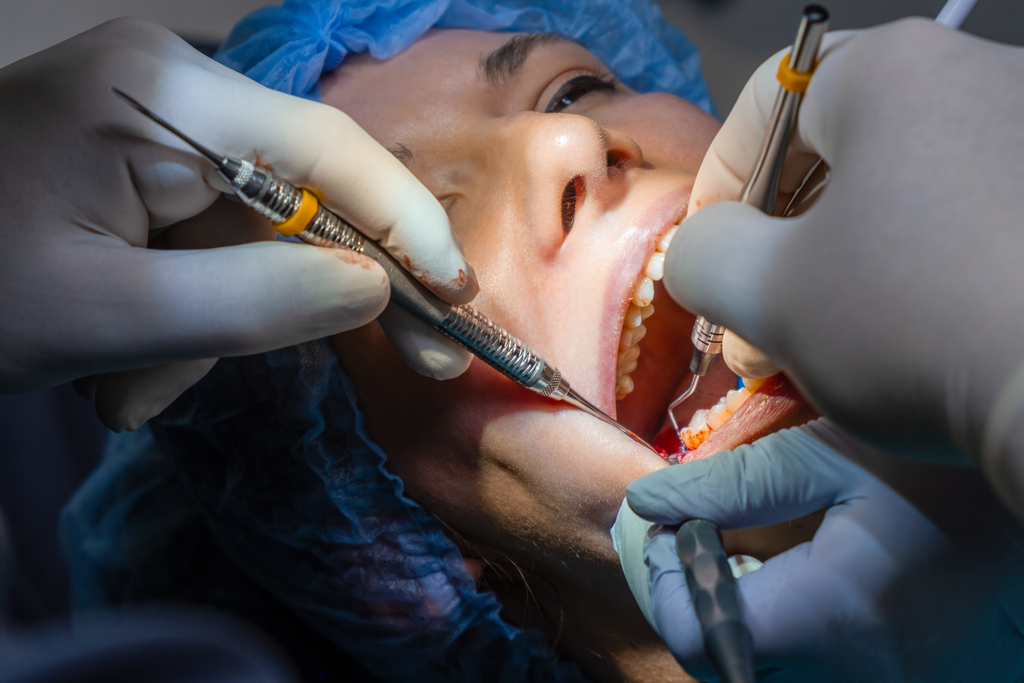 Soft Tissue Grafting Soft Tissue Grafting